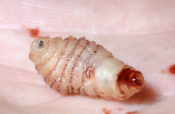 بالصور: تعرفوا على الكائنات الحية التي تعيش بداخل جسم الإنسان! صورة رقم 2 بالصور: تعرفوا على الكائنات الحية التي تعيش بداخل جسم الإنسان! صورة رقم 2