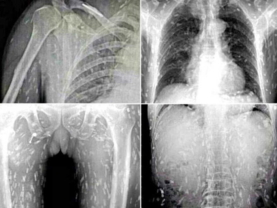 بالصور: تعرفوا على الكائنات الحية التي تعيش بداخل جسم الإنسان! صورة رقم 4 بالصور: تعرفوا على الكائنات الحية التي تعيش بداخل جسم الإنسان! صورة رقم 4