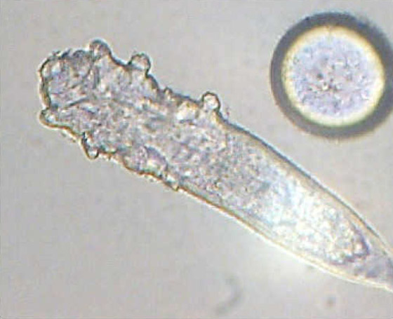 بالصور: تعرفوا على الكائنات الحية التي تعيش بداخل جسم الإنسان! صورة رقم 11 بالصور: تعرفوا على الكائنات الحية التي تعيش بداخل جسم الإنسان! صورة رقم 11