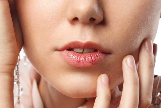 الشفاه تعطي 8 إشارات تحذر من مشكلات صحية خطيرة في الجسم صورة رقم 8