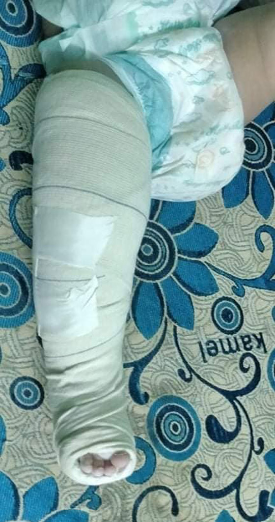 وحشية أب مصري.. عذب رضيعة وكسر أطرافها لرفضه إنجاب الإناث! صورة رقم 9 وحشية أب مصري.. عذب رضيعة وكسر أطرافها لرفضه إنجاب الإناث! صورة رقم 9