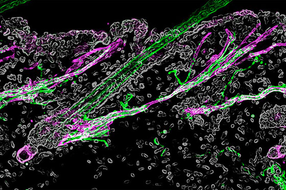 أخيرا توصّل العلم إلى تفسير للظاهرة: لماذا نصاب بالقشعريرة؟! صورة رقم 2