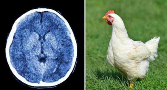 أطباء يفسرون حالة نفسية نادرة لإمرأة تعتقد أنها دجاجة وتتصرف مثلها! صورة رقم 1