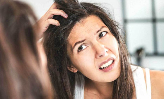 تجنبوا تناول هذه الأطعمة لحماية شعركم من القشرة وإحراجها! صورة رقم 2