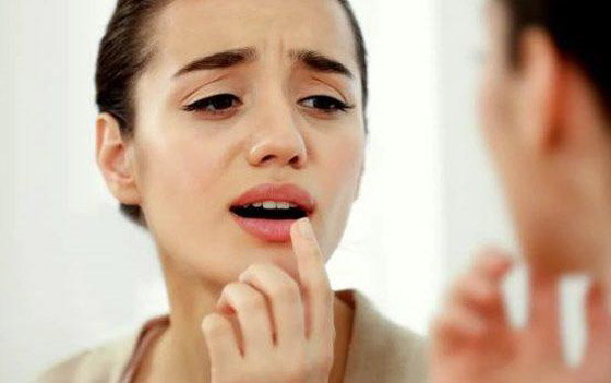 إليكم طريقة ترطيب الشفاه الجافة طبيعيا بخلطة مدهشة من صنع يديكم صورة رقم 1 إليكم طريقة ترطيب الشفاه الجافة طبيعيا بخلطة مدهشة من صنع يديكم صورة رقم 1