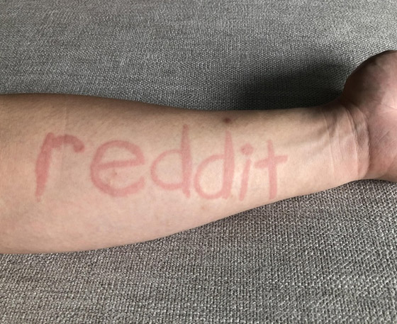 قدرات عجيبة لدى بشر عاديين.. صور صورة رقم 10