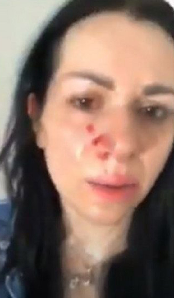 زوجة إعلامي سوري تشتكيه للشرطة بعد أن ضربها بقسوة رغم أنها حامل! صورة رقم 3 زوجة إعلامي سوري تشتكيه للشرطة بعد أن ضربها بقسوة رغم أنها حامل! صورة رقم 3