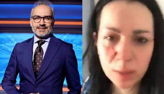 زوجة إعلامي سوري تشتكيه للشرطة بعد أن ضربها بقسوة رغم أنها حامل! صورة رقم 2 زوجة إعلامي سوري تشتكيه للشرطة بعد أن ضربها بقسوة رغم أنها حامل! صورة رقم 2