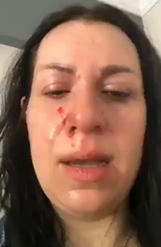 زوجة إعلامي سوري تشتكيه للشرطة بعد أن ضربها بقسوة رغم أنها حامل! صورة رقم 4 زوجة إعلامي سوري تشتكيه للشرطة بعد أن ضربها بقسوة رغم أنها حامل! صورة رقم 4