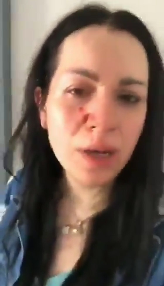زوجة إعلامي سوري تشتكيه للشرطة بعد أن ضربها بقسوة رغم أنها حامل! صورة رقم 5 زوجة إعلامي سوري تشتكيه للشرطة بعد أن ضربها بقسوة رغم أنها حامل! صورة رقم 5