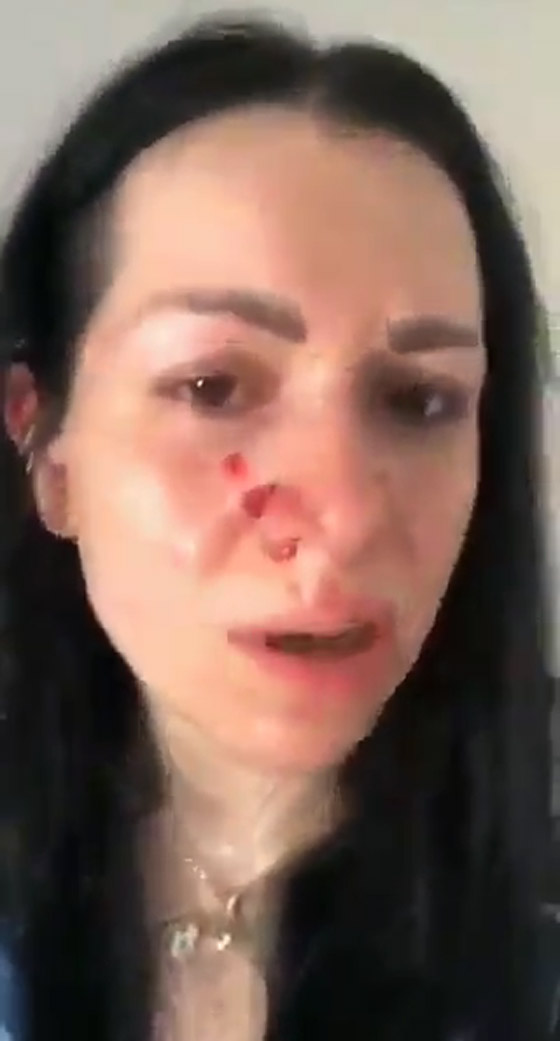 زوجة إعلامي سوري تشتكيه للشرطة بعد أن ضربها بقسوة رغم أنها حامل! صورة رقم 6 زوجة إعلامي سوري تشتكيه للشرطة بعد أن ضربها بقسوة رغم أنها حامل! صورة رقم 6