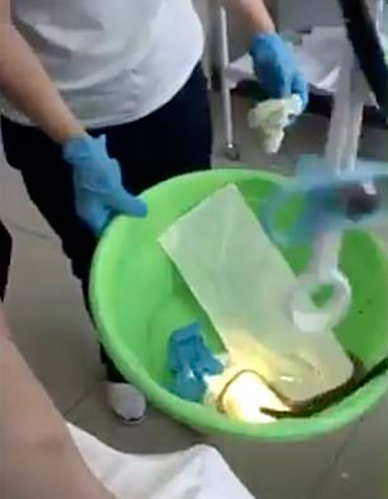 حادثة غريبة.. سيدة تبتلع أفعى عملاقة أثناء نومها صورة رقم 4