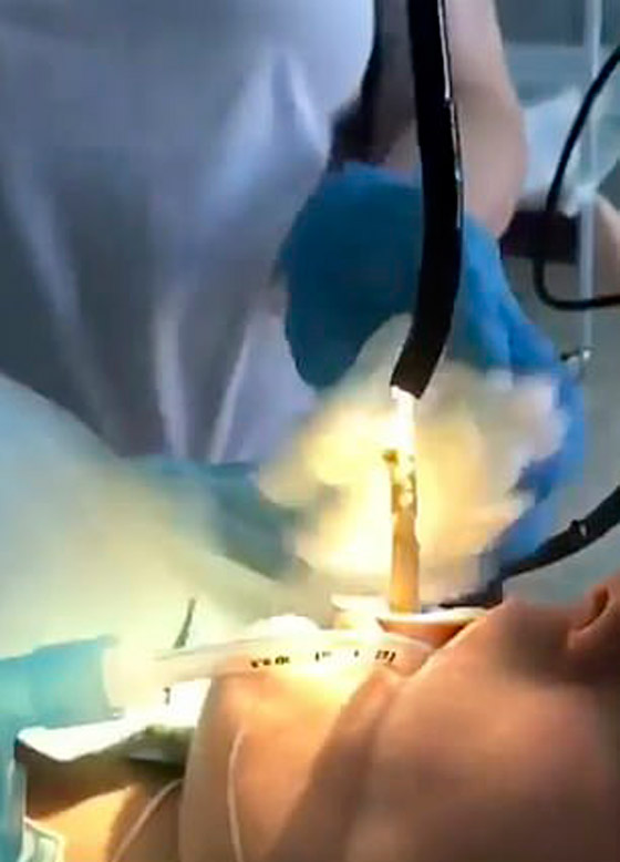 حادثة غريبة.. سيدة تبتلع أفعى عملاقة أثناء نومها صورة رقم 3