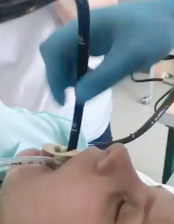 حادثة غريبة.. سيدة تبتلع أفعى عملاقة أثناء نومها صورة رقم 2