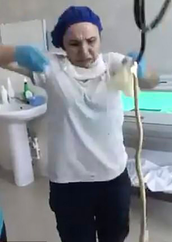 حادثة غريبة.. سيدة تبتلع أفعى عملاقة أثناء نومها صورة رقم 1