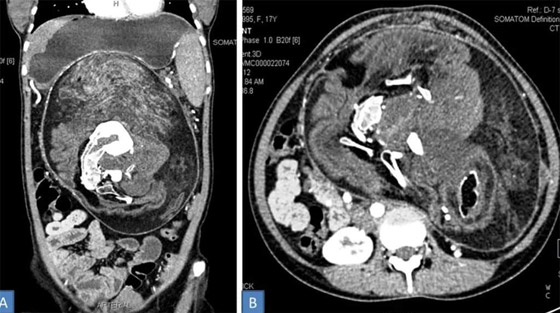 صور: تعرفوا إلى 6 من أغرب أنواع التوائم وأندرها في العالم صورة رقم 11