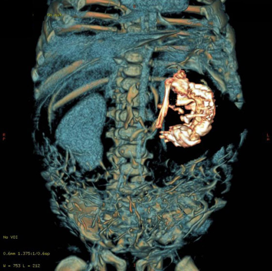 صور: تعرفوا إلى 6 من أغرب أنواع التوائم وأندرها في العالم صورة رقم 13