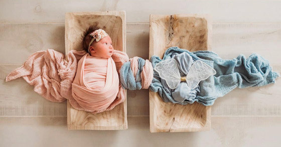 صور: تعرفوا إلى 6 من أغرب أنواع التوائم وأندرها في العالم صورة رقم 14