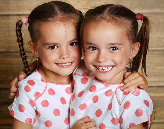 صور: تعرفوا إلى 6 من أغرب أنواع التوائم وأندرها في العالم صورة رقم 15