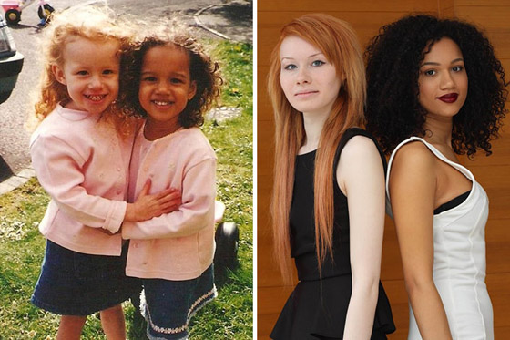 صور: تعرفوا إلى 6 من أغرب أنواع التوائم وأندرها في العالم صورة رقم 18