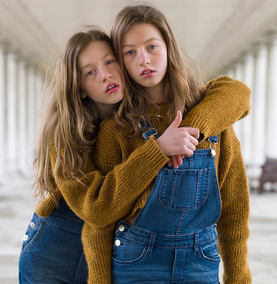 صور: تعرفوا إلى 6 من أغرب أنواع التوائم وأندرها في العالم صورة رقم 20