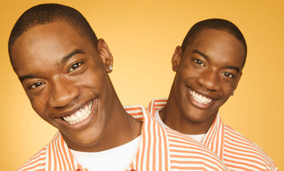 صور: تعرفوا إلى 6 من أغرب أنواع التوائم وأندرها في العالم صورة رقم 21