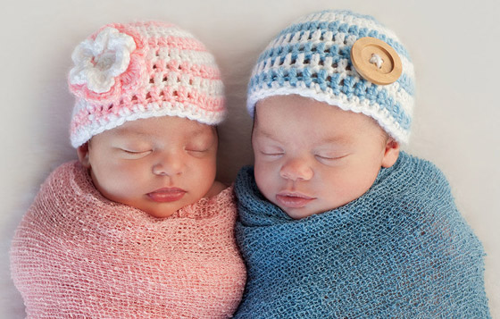 صور: تعرفوا إلى 6 من أغرب أنواع التوائم وأندرها في العالم صورة رقم 1