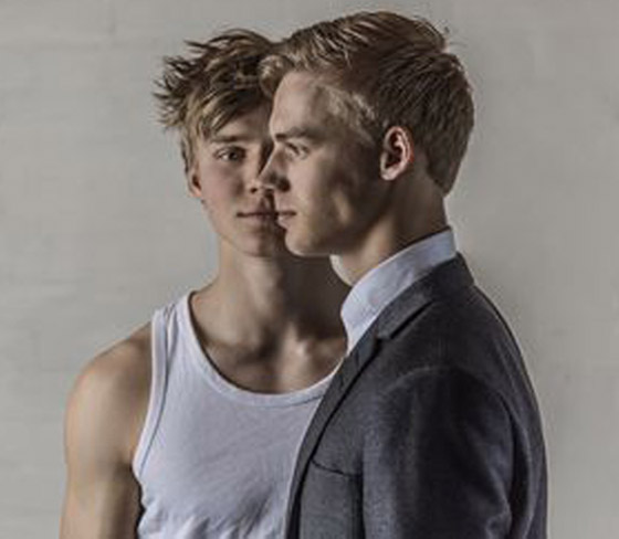 صور: تعرفوا إلى 6 من أغرب أنواع التوائم وأندرها في العالم صورة رقم 22