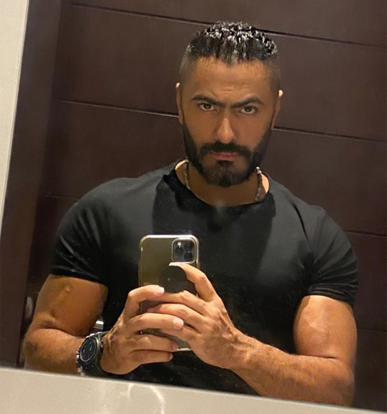 تامر حسني يثير الجدل حول خضوعه لعملية تجميل جديدة بعد التغير الواضح في ملامحه! صورة رقم 3 تامر حسني يثير الجدل حول خضوعه لعملية تجميل جديدة بعد التغير الواضح في ملامحه! صورة رقم 3