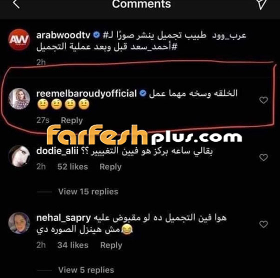 ريم البارودي تسخر من طليقها أحمد سعد وعملية التجميل التي أجراها بعد خطوبته صورة رقم 1 ريم البارودي تسخر من طليقها أحمد سعد وعملية التجميل التي أجراها بعد خطوبته صورة رقم 1