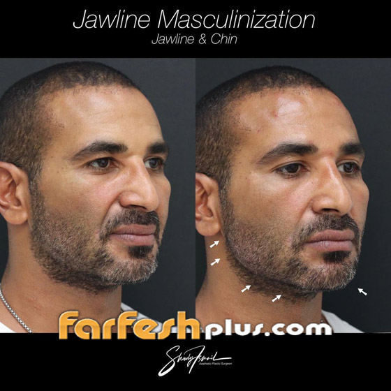 ريم البارودي تسخر من طليقها أحمد سعد وعملية التجميل التي أجراها بعد خطوبته صورة رقم 2 ريم البارودي تسخر من طليقها أحمد سعد وعملية التجميل التي أجراها بعد خطوبته صورة رقم 2