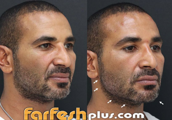 ريم البارودي تسخر من طليقها أحمد سعد وعملية التجميل التي أجراها بعد خطوبته صورة رقم 3 ريم البارودي تسخر من طليقها أحمد سعد وعملية التجميل التي أجراها بعد خطوبته صورة رقم 3