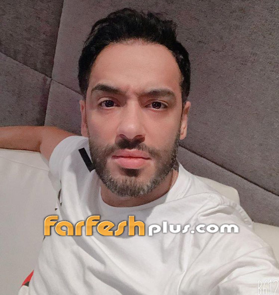 رامي جمال يكشف قرب تعافيه من مرض البهاق وزوجته تمازحه.. صور صورة رقم 4 رامي جمال يكشف قرب تعافيه من مرض البهاق وزوجته تمازحه.. صور صورة رقم 4