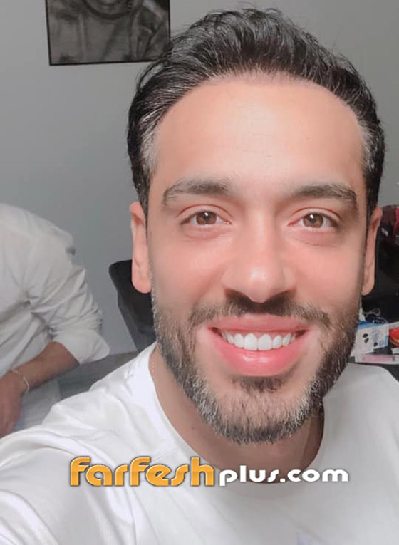 رامي جمال يكشف قرب تعافيه من مرض البهاق وزوجته تمازحه.. صور صورة رقم 5 رامي جمال يكشف قرب تعافيه من مرض البهاق وزوجته تمازحه.. صور صورة رقم 5
