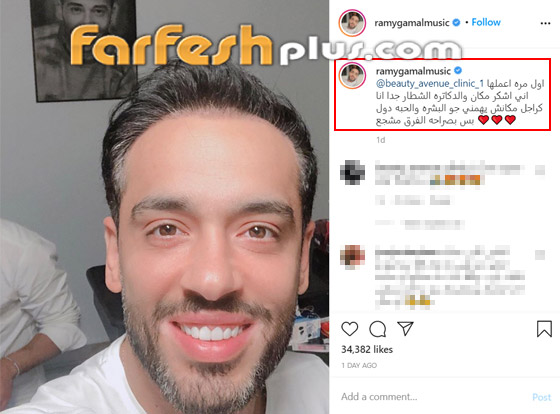رامي جمال يكشف قرب تعافيه من مرض البهاق وزوجته تمازحه.. صور صورة رقم 2 رامي جمال يكشف قرب تعافيه من مرض البهاق وزوجته تمازحه.. صور صورة رقم 2