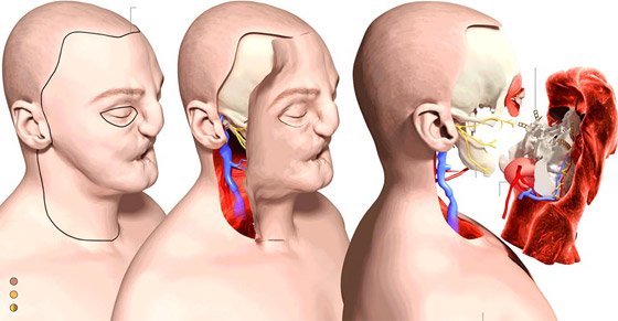 تعرفوا إلى أغرب 10 علاجات وإجراءات طبية اتبعها الأطباء حول العالم صورة رقم 1
