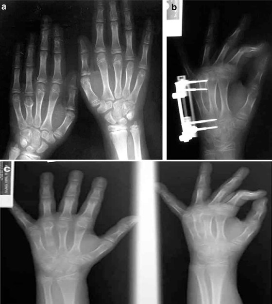 تعرفوا إلى أغرب 10 علاجات وإجراءات طبية اتبعها الأطباء حول العالم صورة رقم 4