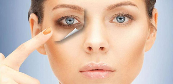 3 ماسكات طبيعية مجربة لعلاج الهالات السوداء قبل الزفاف صورة رقم 3