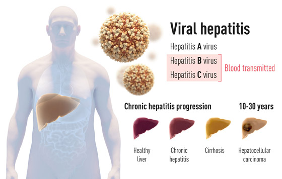 الفائزون بجائزة نوبل في الطب 2020: اكتشفوا فيروس وأنقذوا حياة الملايين صورة رقم 15