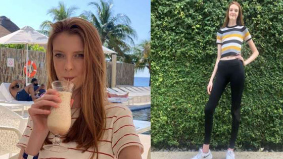 فيديو وصور: فتاة تمتلك أطول ساقين في العالم.. يزيد طولها على مترين! صورة رقم 14