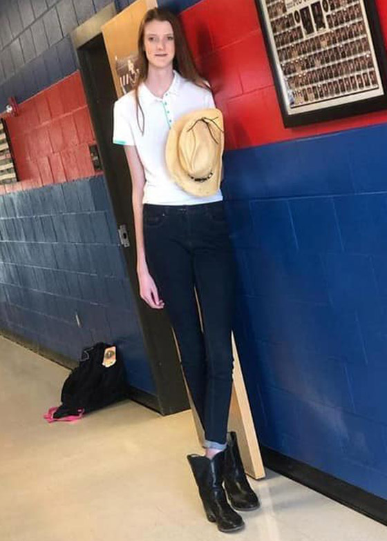 فيديو وصور: فتاة تمتلك أطول ساقين في العالم.. يزيد طولها على مترين! صورة رقم 15