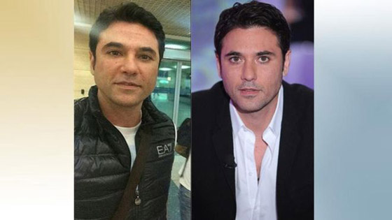 صور.. مشاهير رجال أدمنوا حقن البوتوكس وشد الوجه! صورة رقم 2