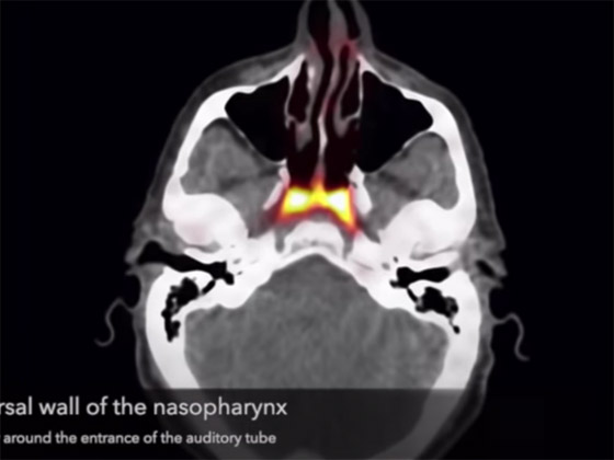 حدث طبي نادر أصاب العلماء بالذهول.. اكتشاف أعضاء جديدة في الإنسان! صورة رقم 2