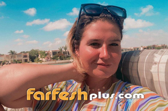 هنا شيحة بملامح وجه مختلفة.. ومتابعون: بكفي تجميل خربتي وجهك! صورة رقم 8