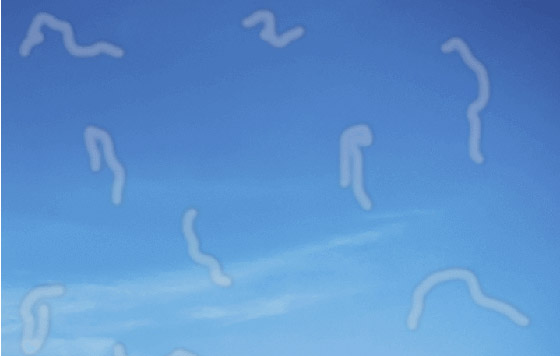 ما هي الأجسام العائمة التي نراها أحيانا ومتى تكون مؤشرا لمشاكل صحية؟ صورة رقم 2 ما هي الأجسام العائمة التي نراها أحيانا ومتى تكون مؤشرا لمشاكل صحية؟ صورة رقم 2
