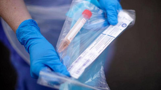 إنجاز عالمي جديد.. شركة مودرنا تعلن نجاح لقاح كورونا صورة رقم 6