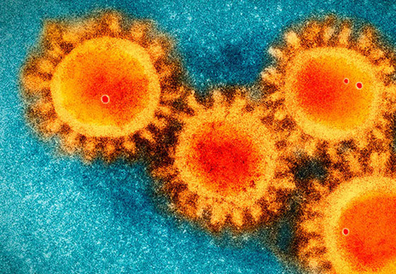 جائحة معلوماتية بامتياز.. إليكم أخبار غريبة وشائعات انتشرت في 2020! صورة رقم 2