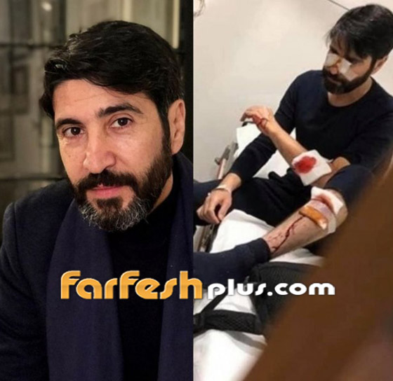 حصاد 2020: نجوم عرب نجوا بأعجوبة هذا العام من حوادث خطيرة! صورة رقم 2 حصاد 2020: نجوم عرب نجوا بأعجوبة هذا العام من حوادث خطيرة! صورة رقم 2