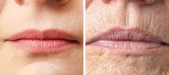 تعرفوا إلى 7 أجزاء في الجسم تكشف عن التقدم في العمر..! صورة رقم 1