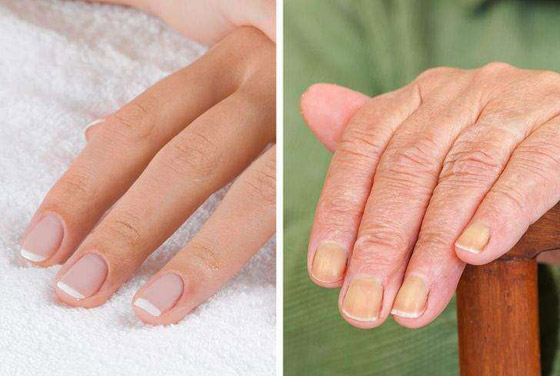 تعرفوا إلى 7 أجزاء في الجسم تكشف عن التقدم في العمر..! صورة رقم 2